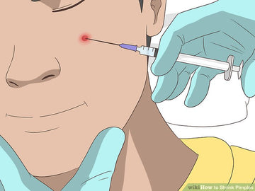 Cách trị mụn mủ sưng to nhanh chóng và hiệu quả