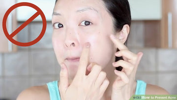 Cách trị mụn trứng cá ở tuổi dậy thì tại nhà