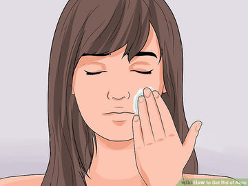 Cách trị mụn trứng cá tuổi dậy thì tại nhà