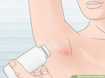 Cách trị mụn ở nách sưng to đau tại nhà