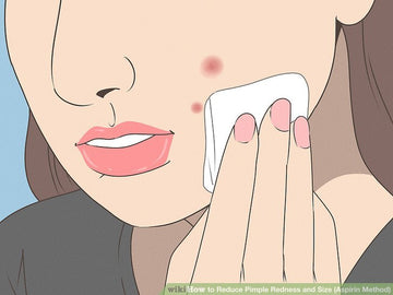 Aspirin trị mụn: 7 bước sử dụng an toàn