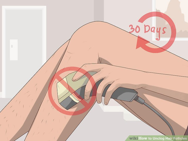 Cách trị viêm nang lông hiệu quả tại nhà