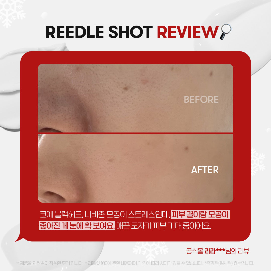 Tinh Chất VT Reedle Shot 100 Essence - Kallos Vietnam