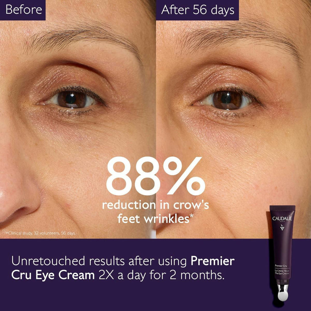 Kem Dưỡng Mắt Caudalie Premier Cru The Eye Cream