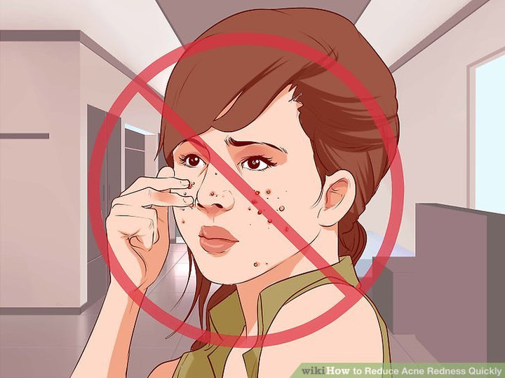 Cách làm xẹp mụn sưng đỏ sau một đêm