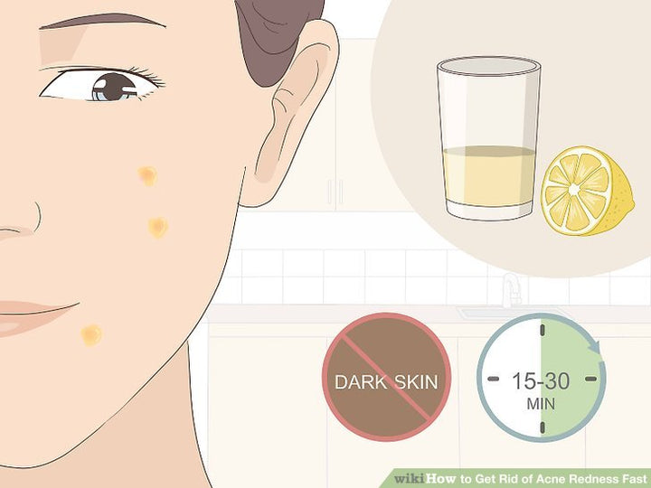Cách làm giảm mụn sưng đỏ tại nhà