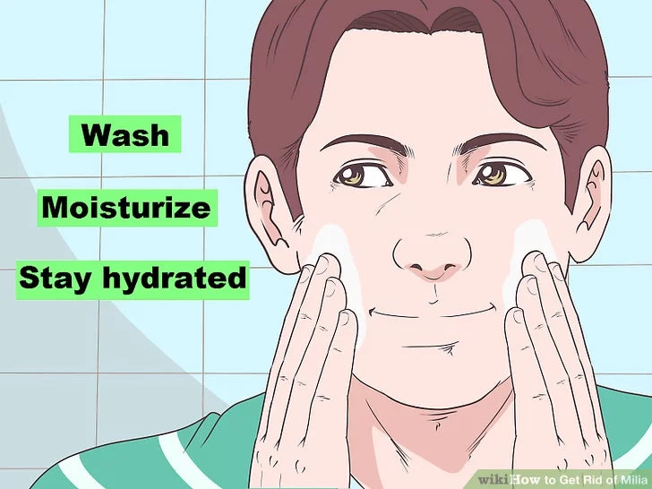 Cách trị mụn đầu trắng nhỏ li ti tại nhà