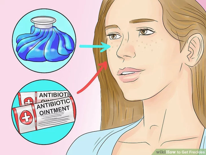 Cách trang điểm tàn nhang tự nhiên và quyến rũ