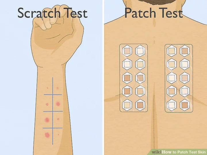Test áp bì (Patch test): 7 bước thực hiện tại nhà