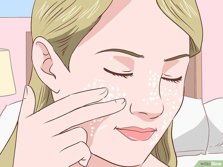 Cách lấy nhân mụn ẩn dưới da tại nhà - Kallos Vietnam