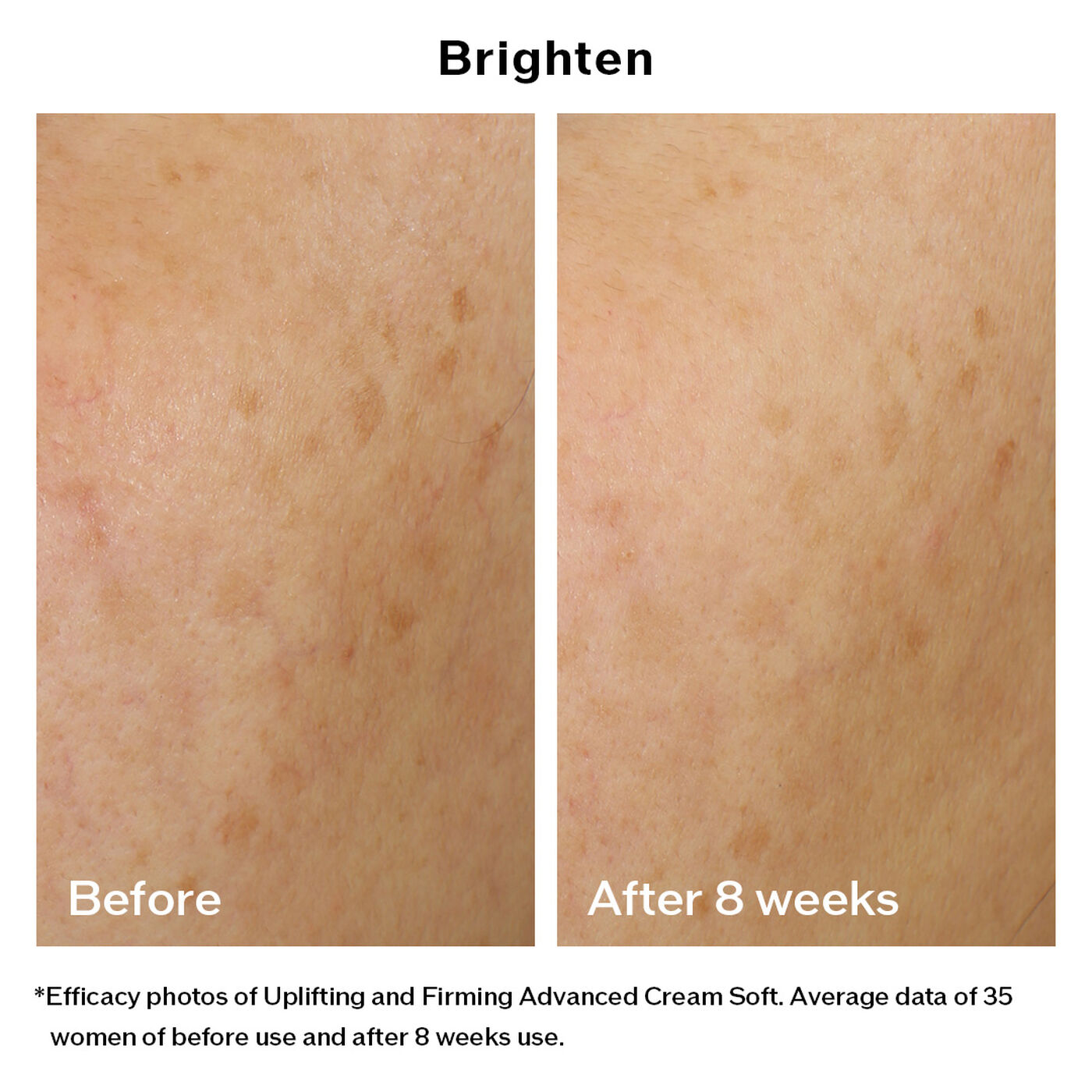 Kem Dưỡng SHISEIDO Vital Perfection Uplifting and Firming Advanced Cream Soft - Kallos Vietnam