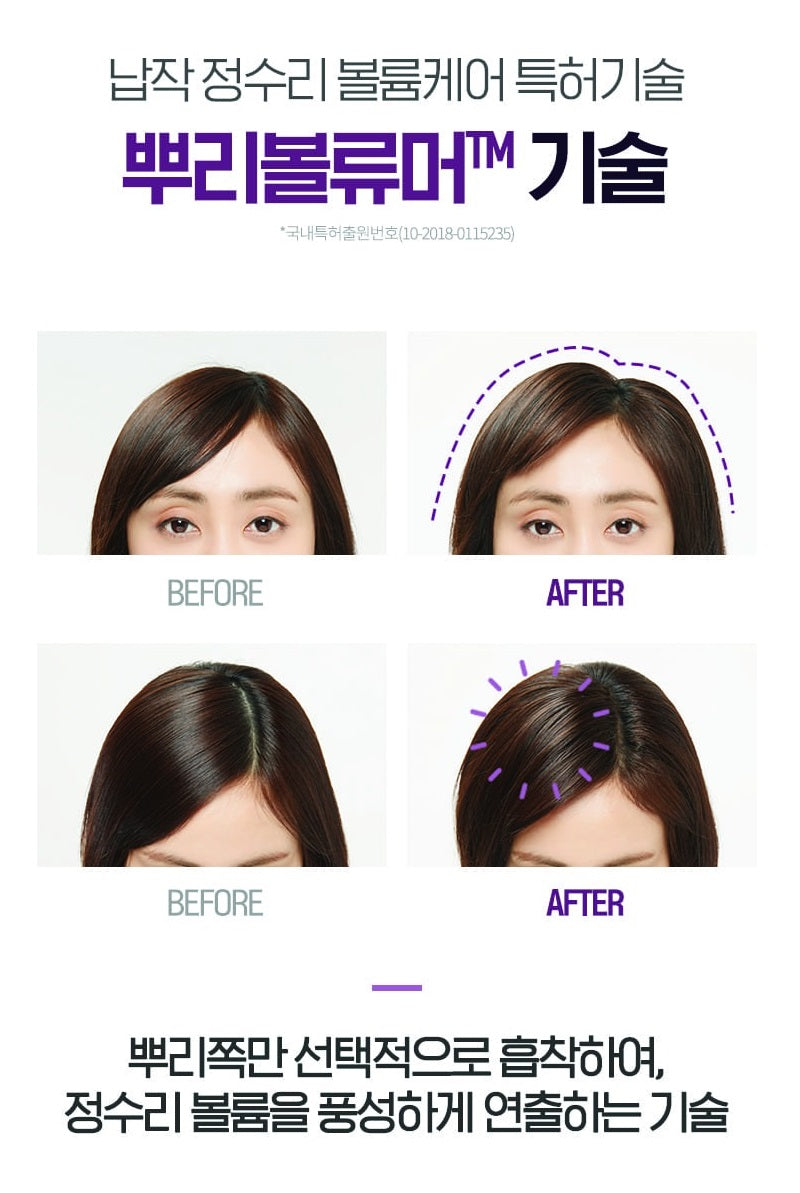 Kem Ủ Tóc RYO Hair Loss Expert Care Treatment Root Strength-Kallos