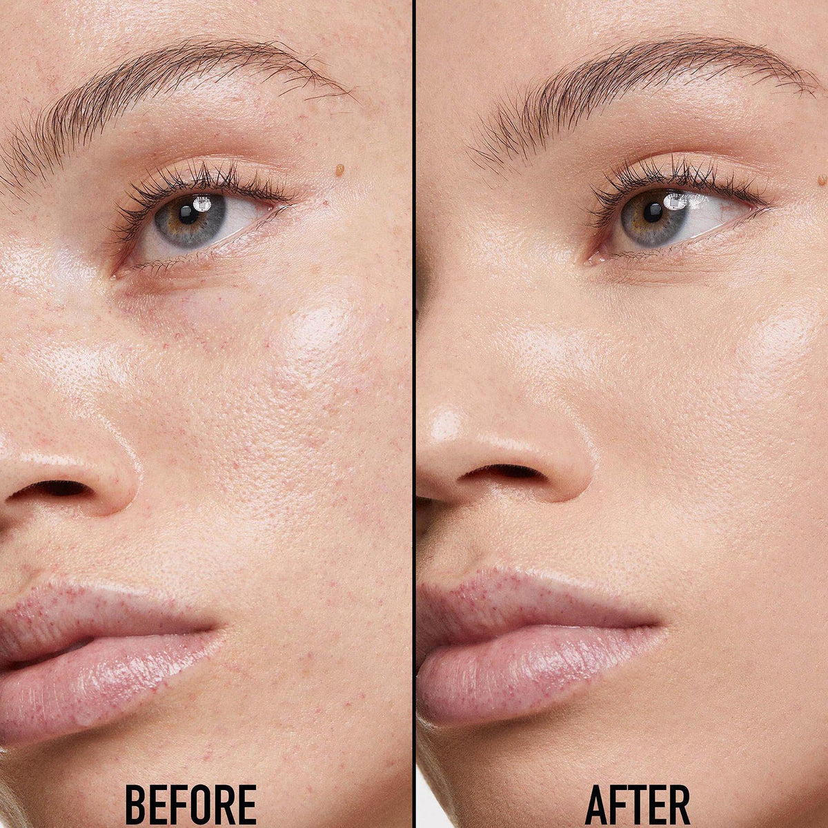 Kem Che Khuyết Điểm Dior Forever Skin Correct #1.5N Neutral - Kallos Vietnam