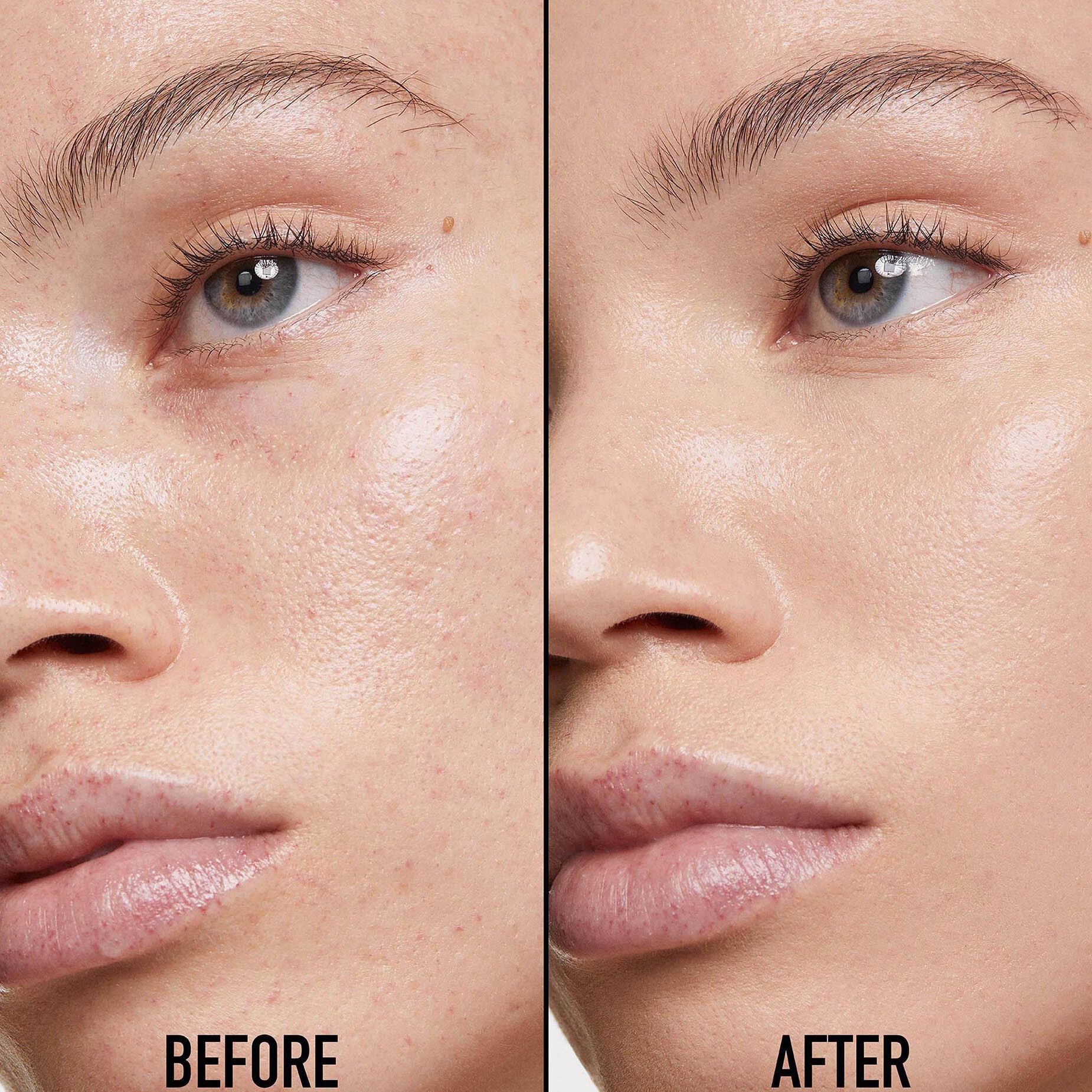 Kem Che Khuyết Điểm Dior Forever Skin Correct #1.5N Neutral - Kallos Vietnam