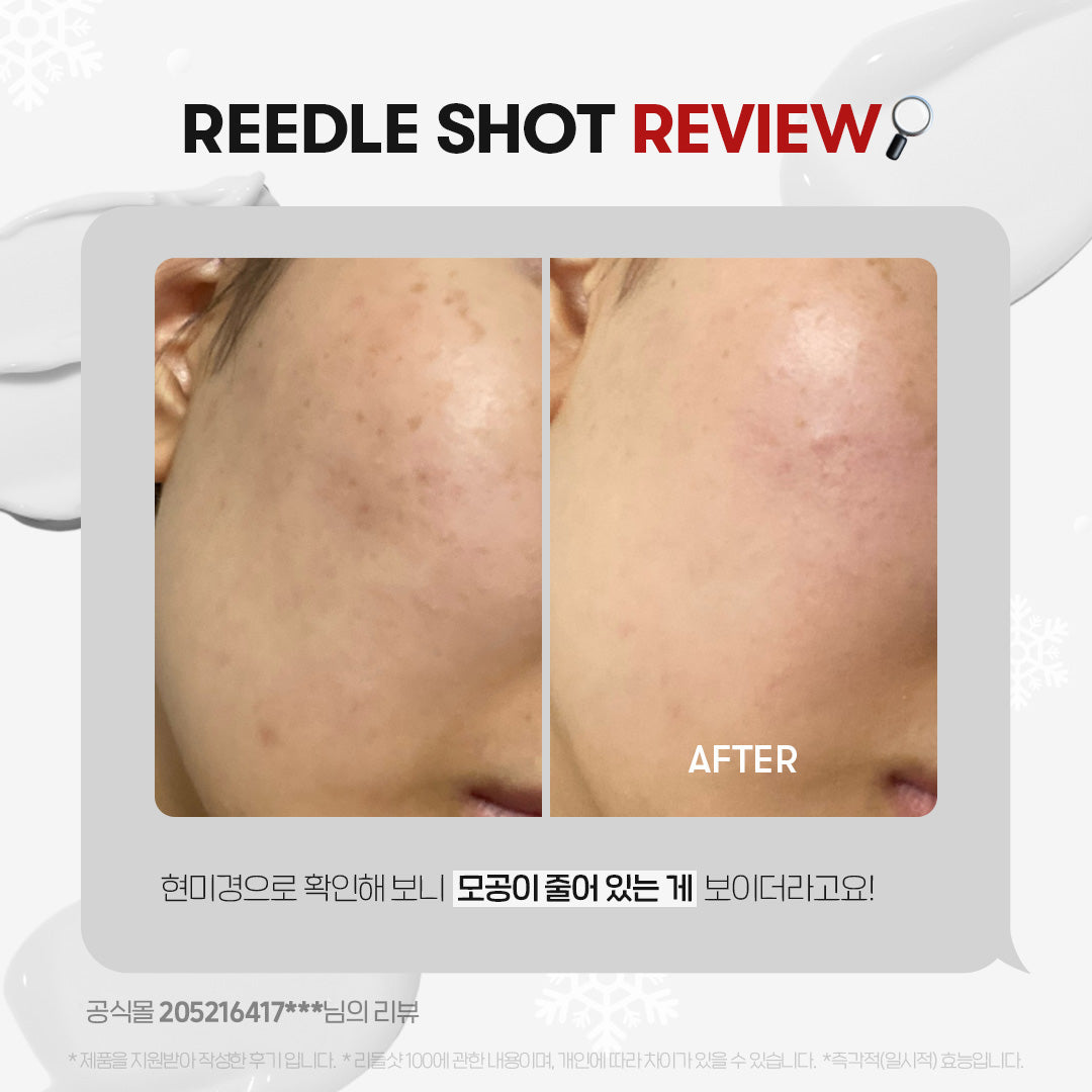 Tinh Chất VT Reedle Shot 300 Essence - Kallos Vietnam