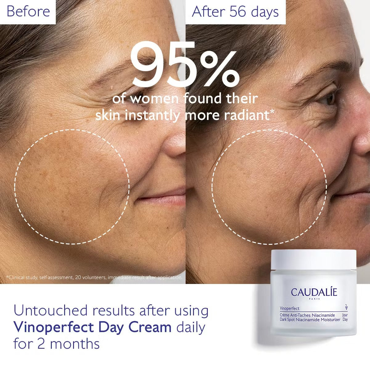 Bộ Kem Dưỡng Caudalie Vinoperfect Dark Spot Moisturizer & Night Cream