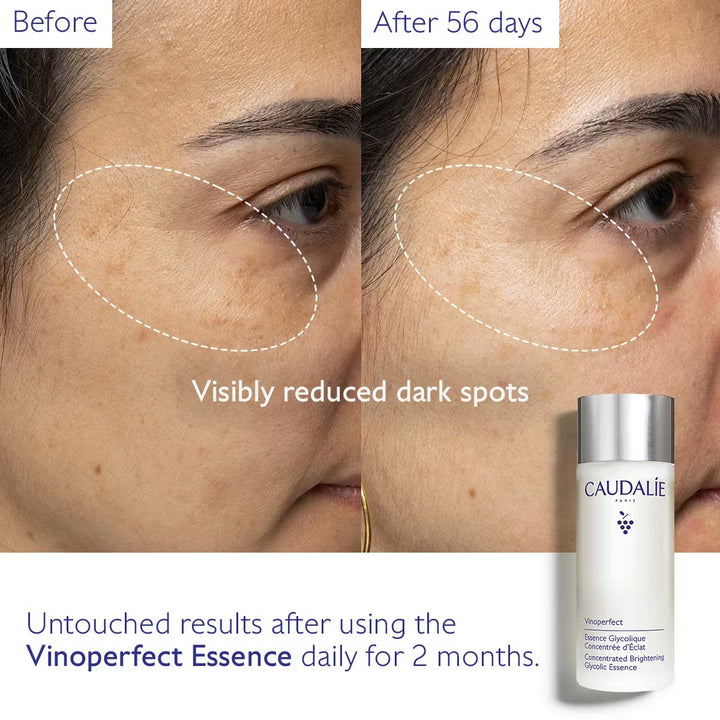 Bộ Nước Hoa Hồng Caudalie Vinoperfect Concentrated Brightening Glycolic Essence-Kallos