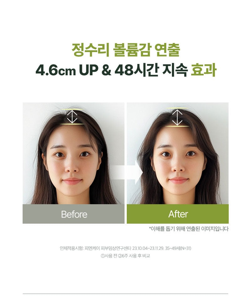 Dầu Gội RYO Rootgen For Women Hair Loss Treatment Shampoo Refill
