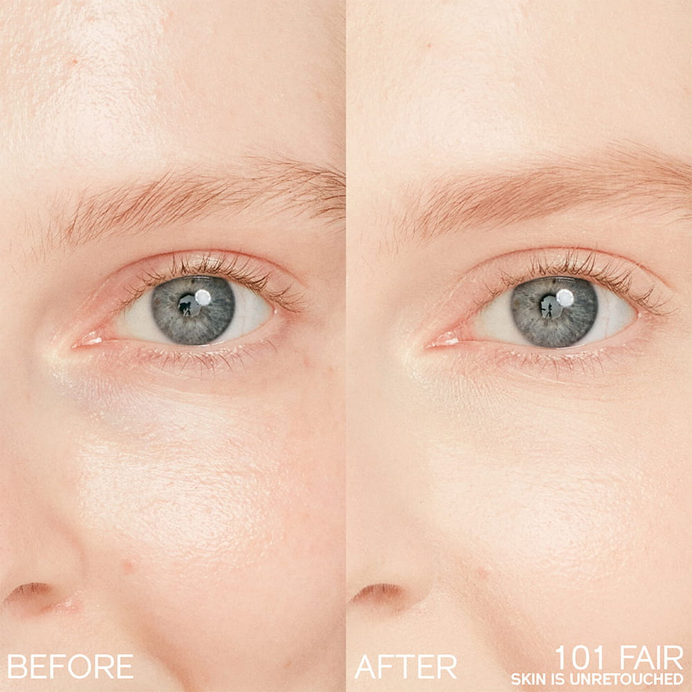 Kem Che Khuyết Điểm SHISEIDO Synchro Skin Radiant Lifting Concealer #101 Fair-Kallos