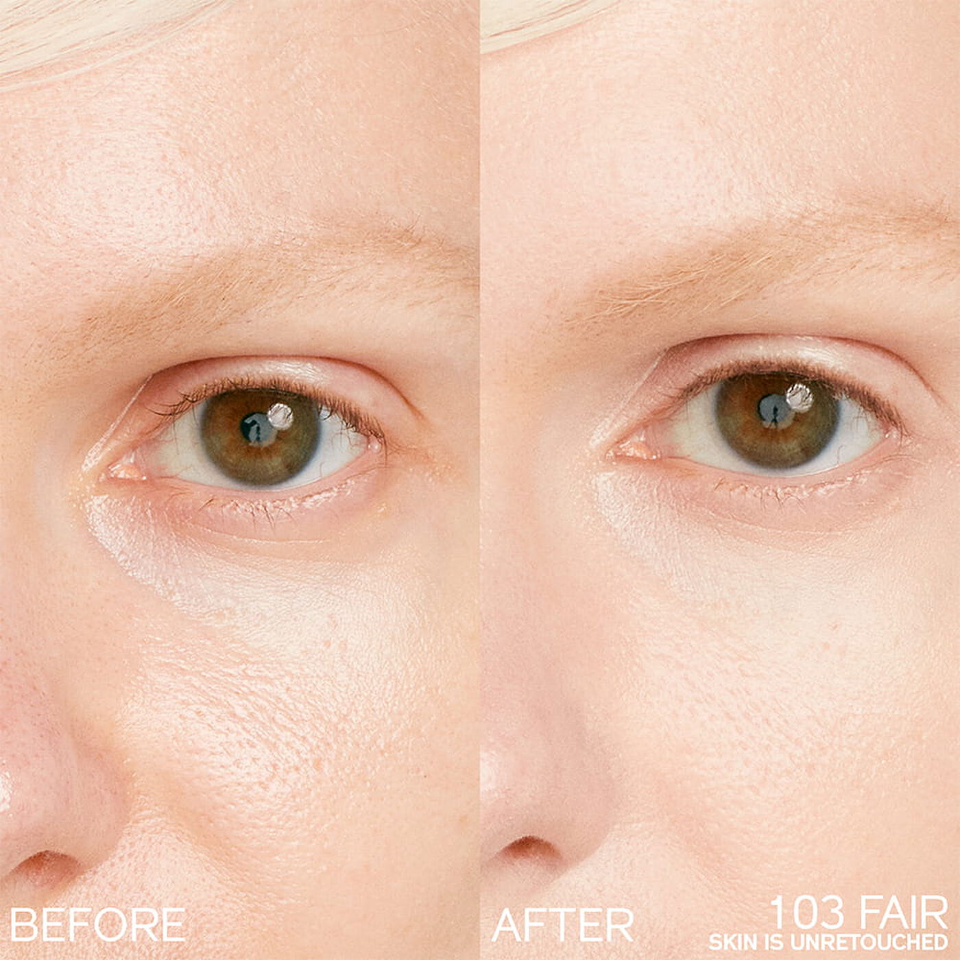 Kem Che Khuyết Điểm SHISEIDO Synchro Skin Radiant Lifting Concealer #103 Fair-Kallos