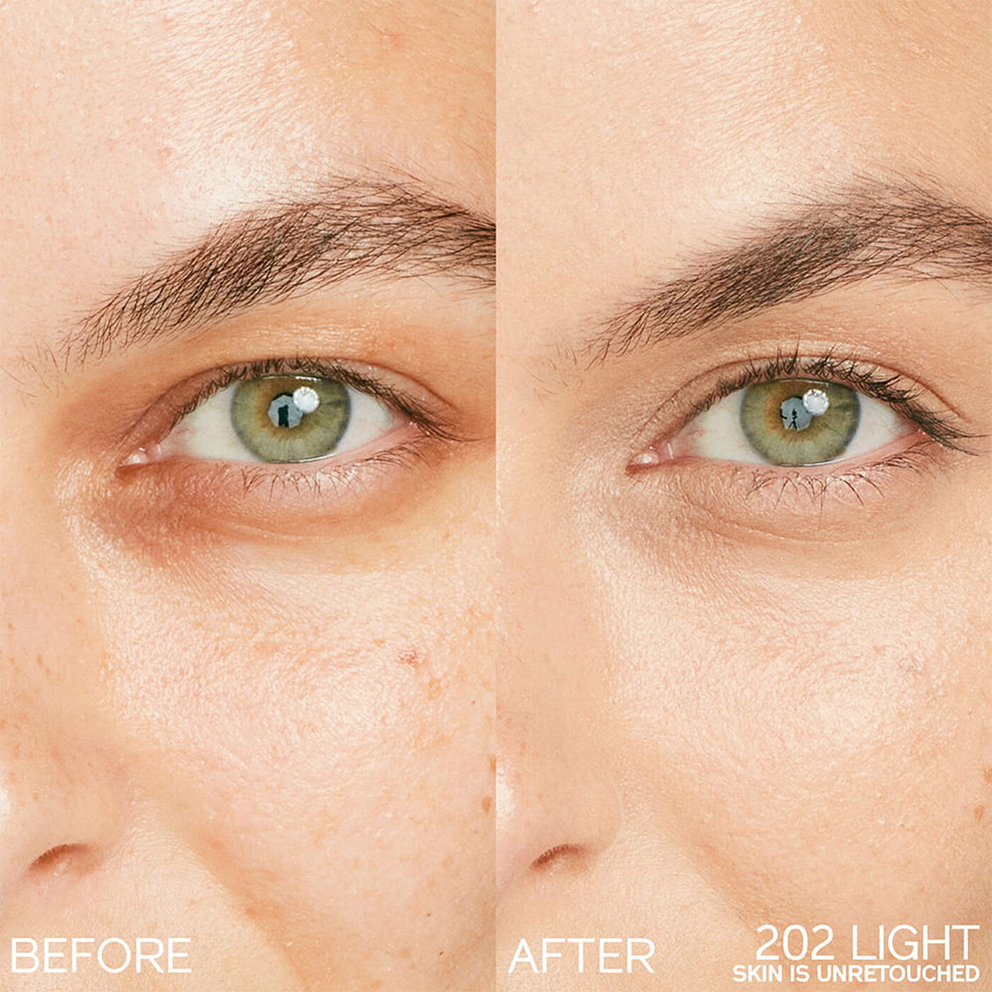Kem Che Khuyết Điểm SHISEIDO Synchro Skin Radiant Lifting Concealer #202 Light-Kallos