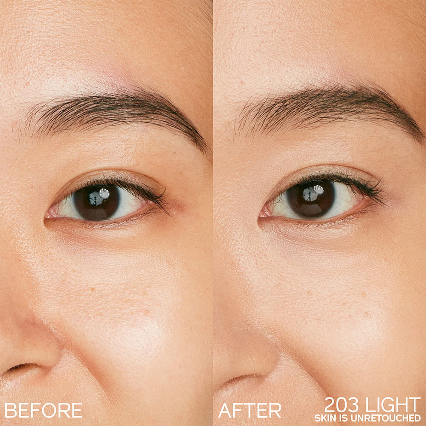 Kem Che Khuyết Điểm SHISEIDO Synchro Skin Radiant Lifting Concealer #203 Light-Kallos