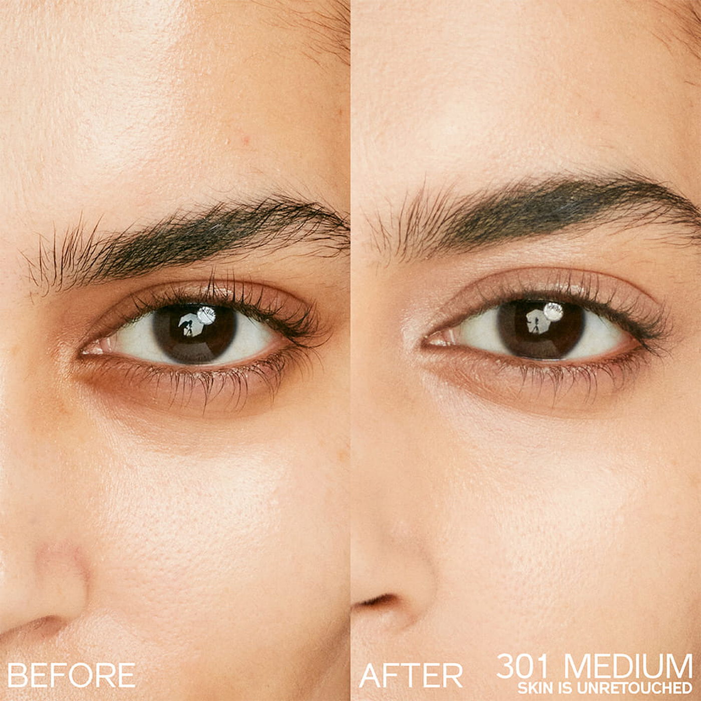 Kem Che Khuyết Điểm SHISEIDO Synchro Skin Radiant Lifting Concealer #301 Medium-Kallos