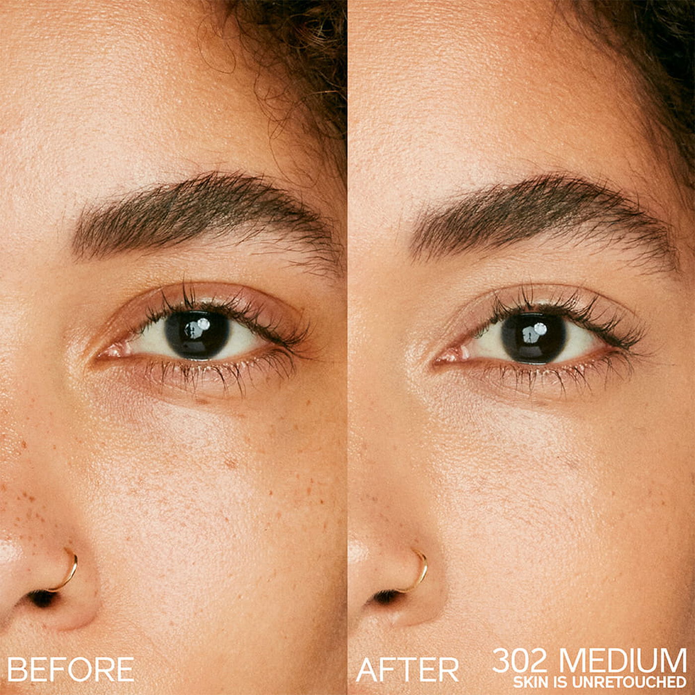 Kem Che Khuyết Điểm SHISEIDO Synchro Skin Radiant Lifting Concealer #302 Medium-Kallos