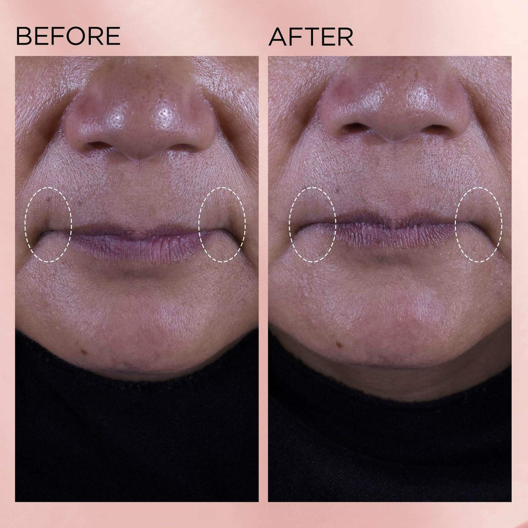 Kem Dưỡng Elizabeth Arden Retinol + HPR Ceramide Water Cream