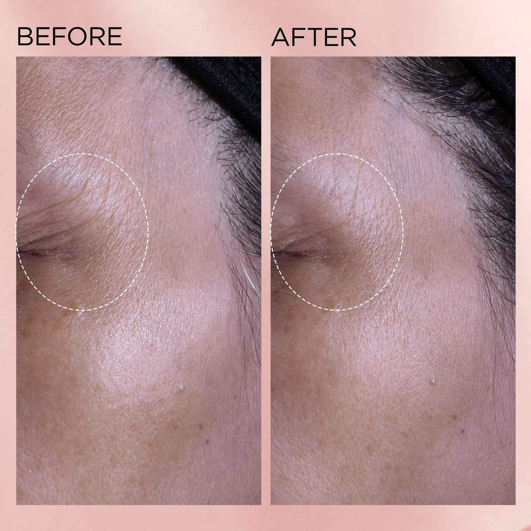 Kem Dưỡng Elizabeth Arden Retinol + HPR Ceramide Water Cream