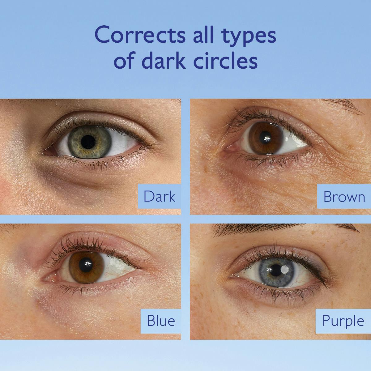 Kem Dưỡng Mắt Caudalie Vinoperfect Dark Circle Brightening Eye Cream