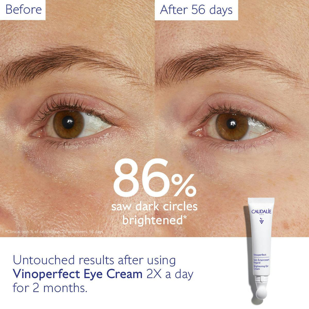 Kem Dưỡng Mắt Caudalie Vinoperfect Dark Circle Brightening Eye Cream