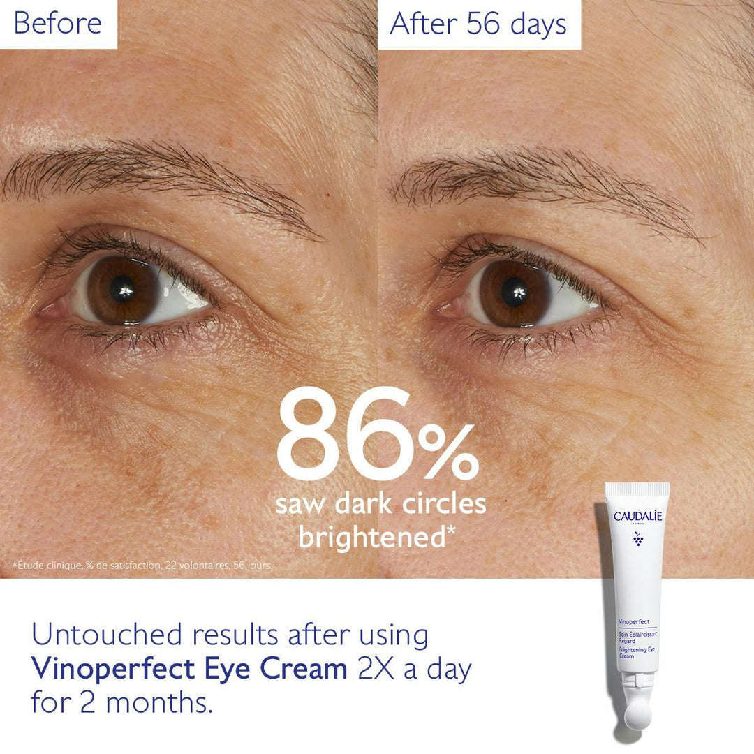 Kem Dưỡng Mắt Caudalie Vinoperfect Dark Circle Brightening Eye Cream