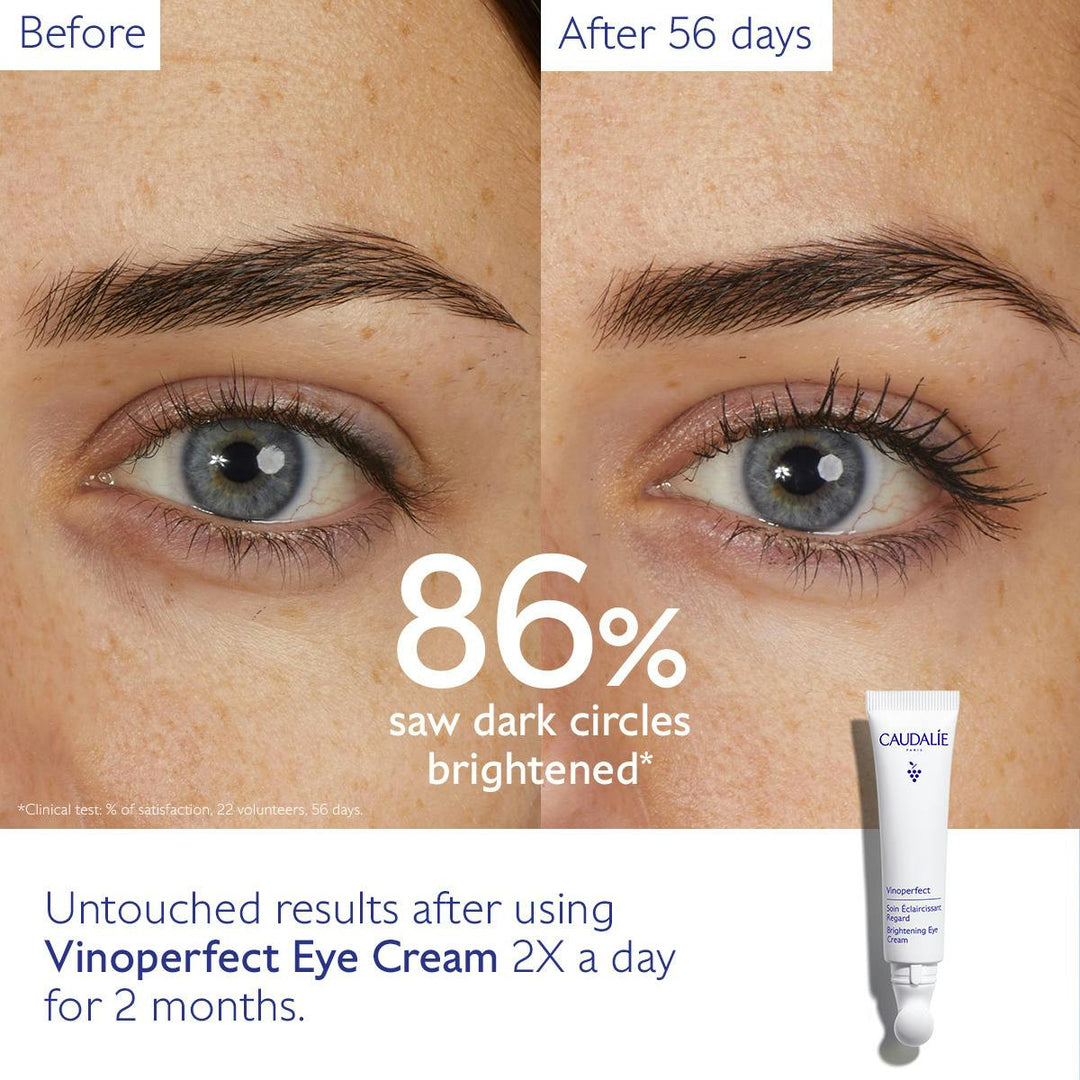 Kem Dưỡng Mắt Caudalie Vinoperfect Dark Circle Brightening Eye Cream