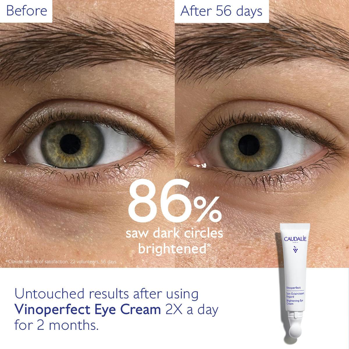 Kem Dưỡng Mắt Caudalie Vinoperfect Dark Circle Brightening Eye Cream