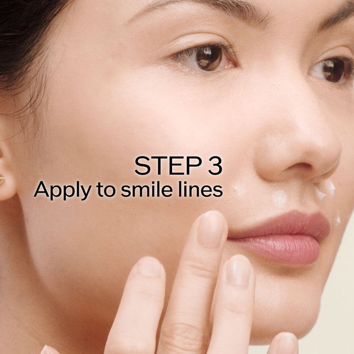 Kem Dưỡng SHISEIDO Vital Perfection Intensive WrinkleSpot Treatment - Kallos Vietnam