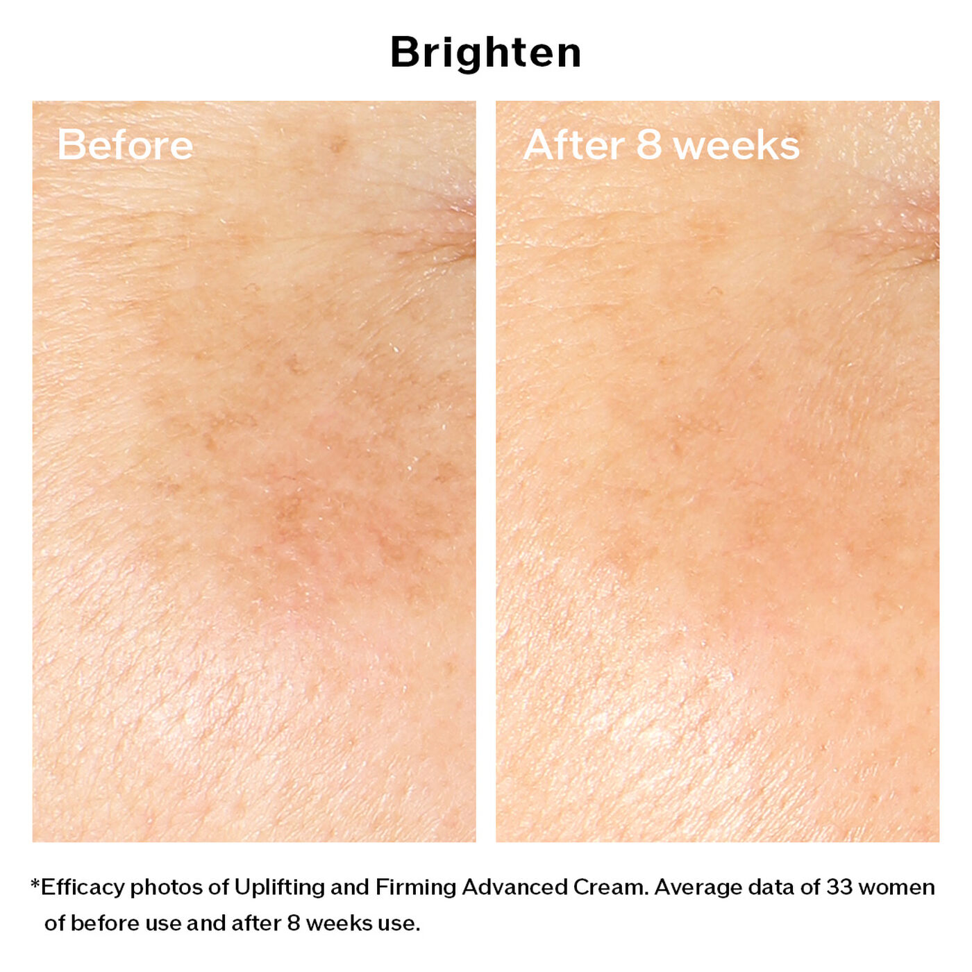 Kem Dưỡng SHISEIDO Vital Perfection Uplifting and Firming Advanced Cream - Kallos Vietnam