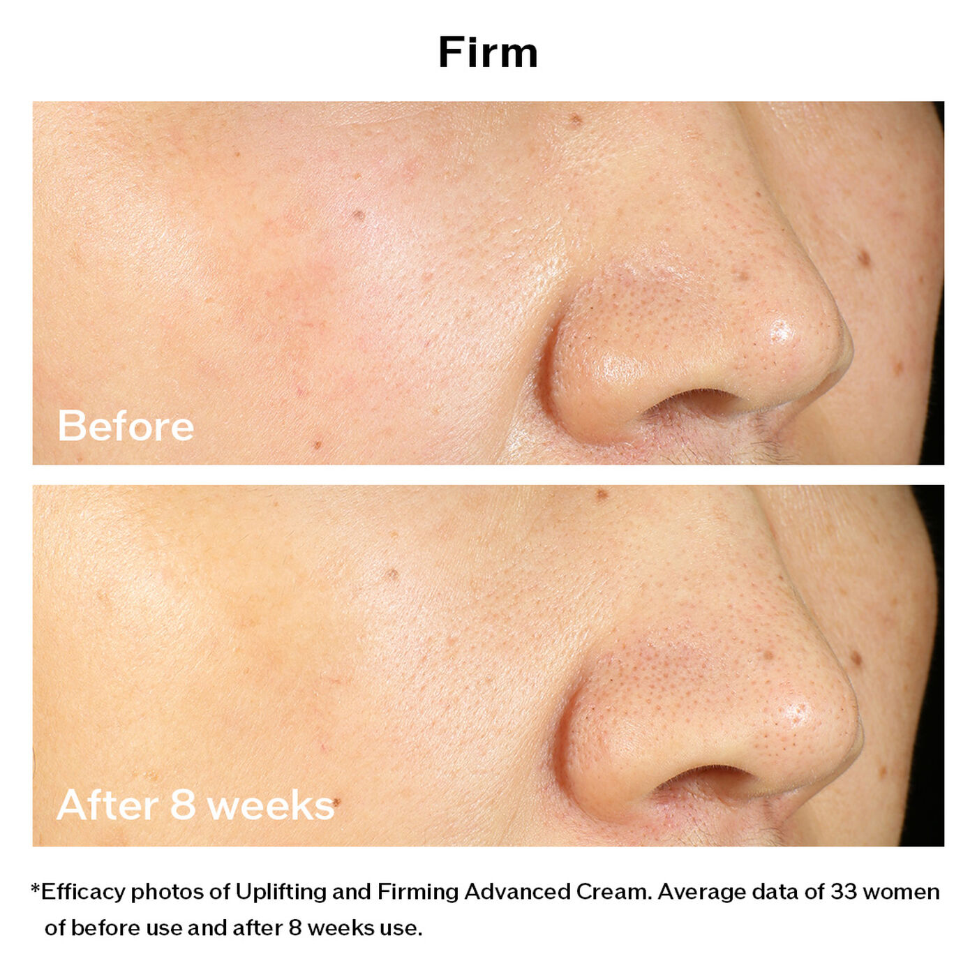Kem Dưỡng SHISEIDO Vital Perfection Uplifting and Firming Advanced Cream - Kallos Vietnam