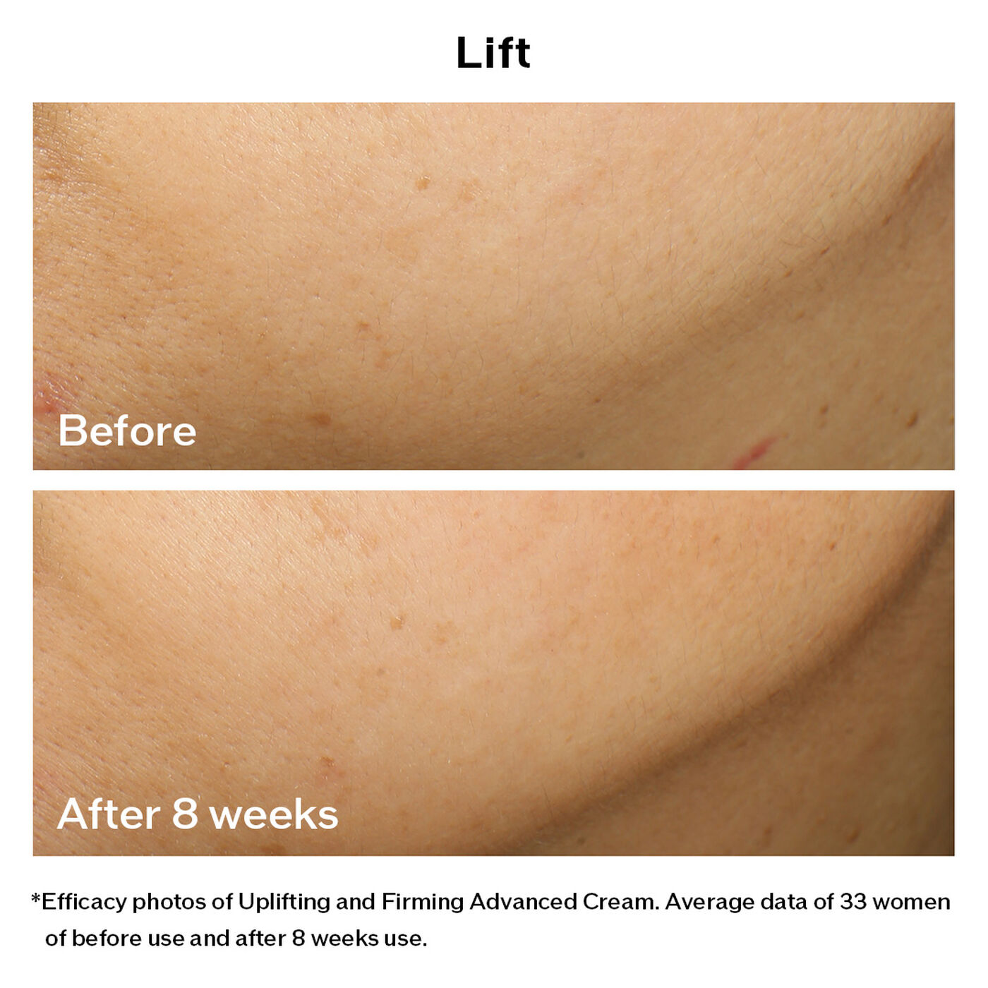 Kem Dưỡng SHISEIDO Vital Perfection Uplifting and Firming Advanced Cream - Kallos Vietnam