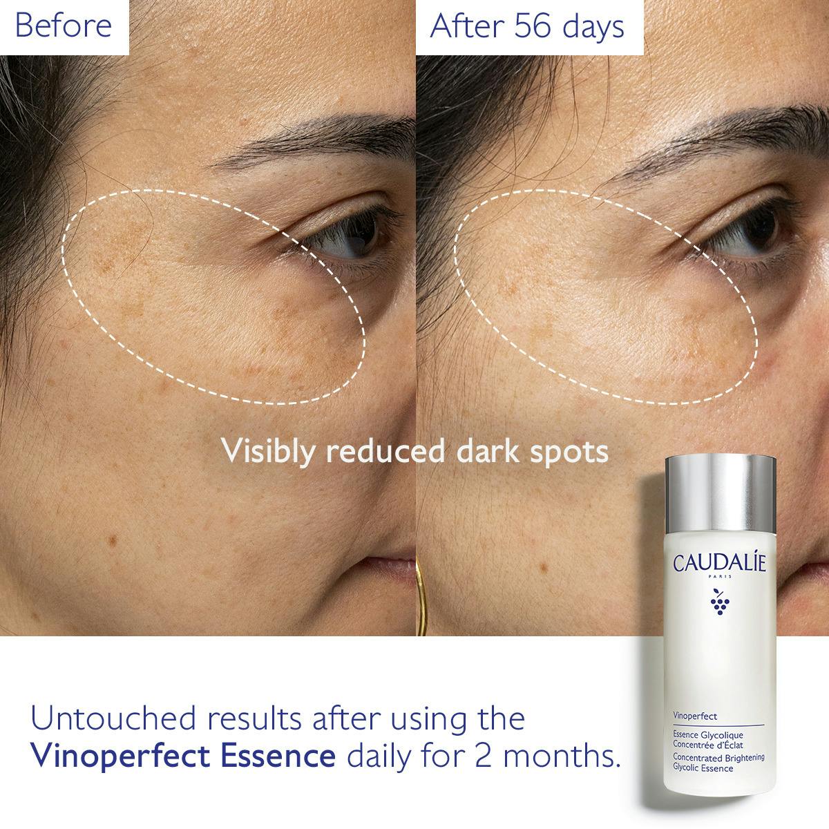 Nước Hoa Hồng Caudalie Vinoperfect Concentrated Brightening Glycolic Essence