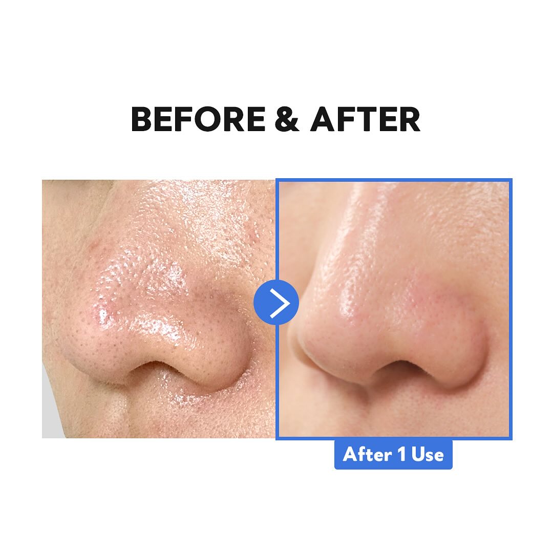 Sáp Tẩy Trang TIRTIR Hydro Boost Enzyme Cleansing Balm