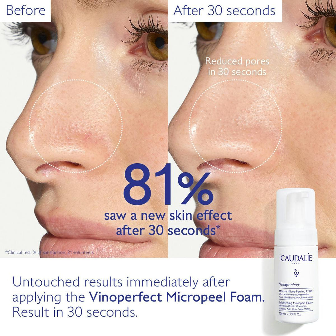 Sữa Rửa Mặt Caudalie Vinoperfect Brightening AHA Micropeel #100 mL