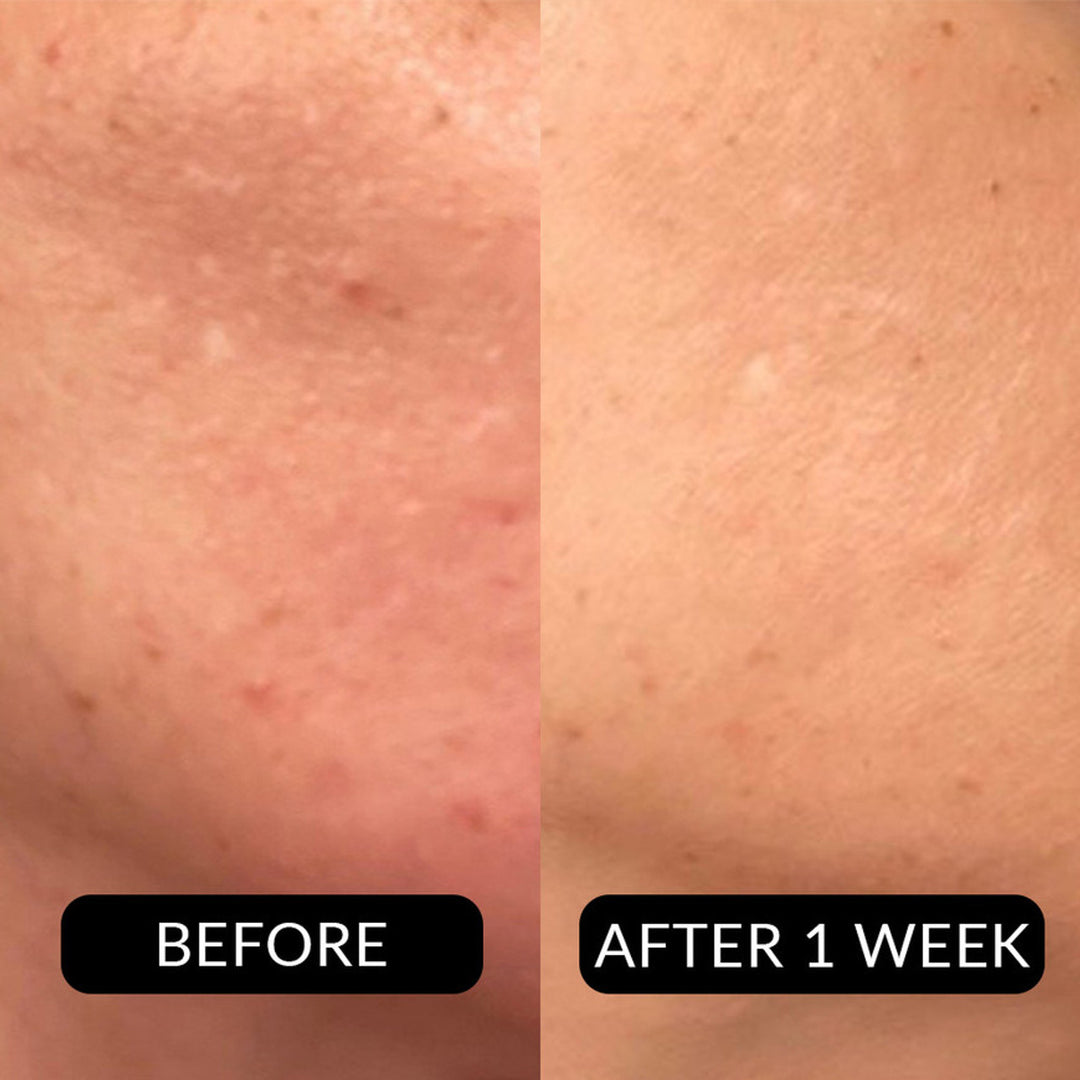 Tẩy Da Chết Pevonia ProCorrective Clear-Control Exfoliator #150 mL
