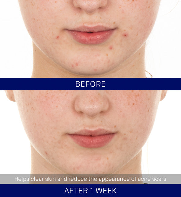 Tinh Chất Augustinus Bader The Retinol Serum #30 mL