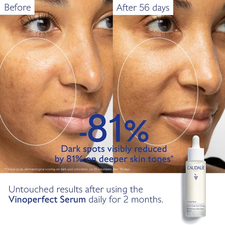 Tinh Chất Caudalie Vinoperfect Brightening Dark Spot Serum 50 mL Set-Kallos