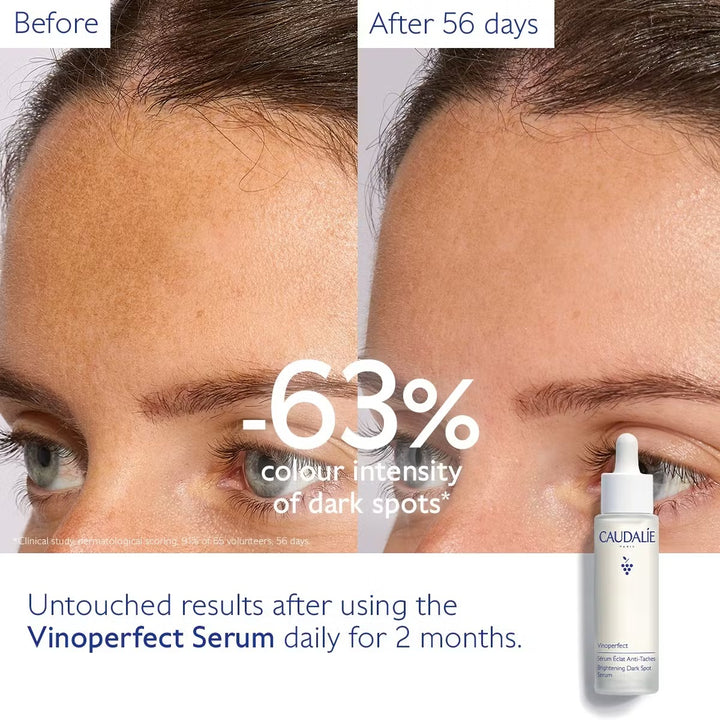 Tinh Chất Caudalie Vinoperfect Brightening Dark Spot Serum 50 mL Set-Kallos