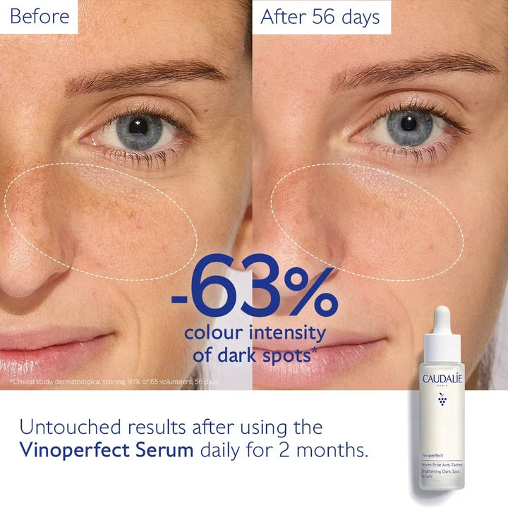 Tinh Chất Caudalie Vinoperfect Brightening Dark Spot Serum 50 mL Set-Kallos