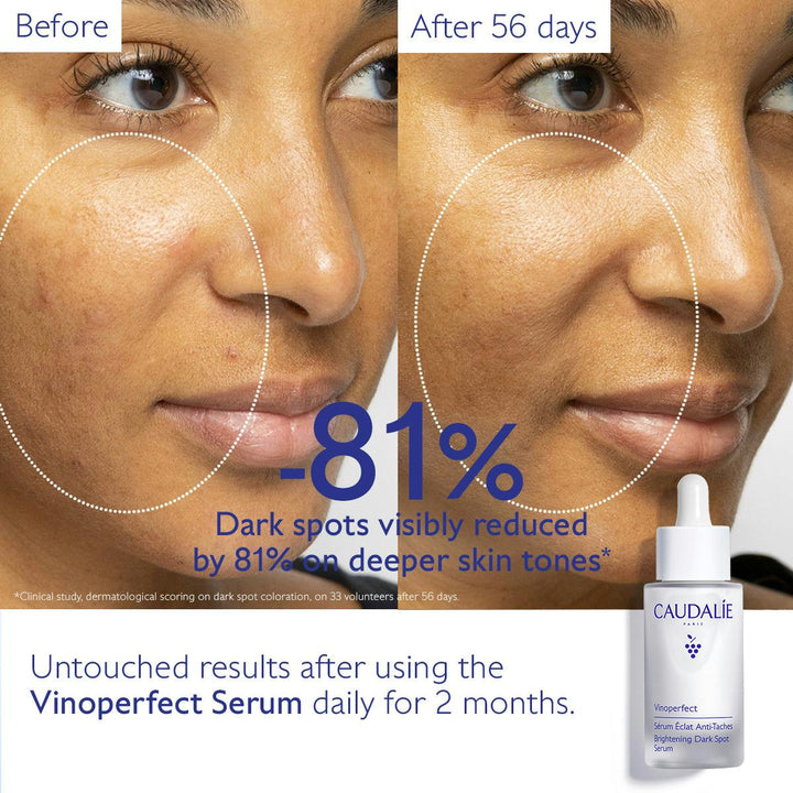 Tinh Chất Caudalie Vinoperfect Dark Spot Brightening Serum 