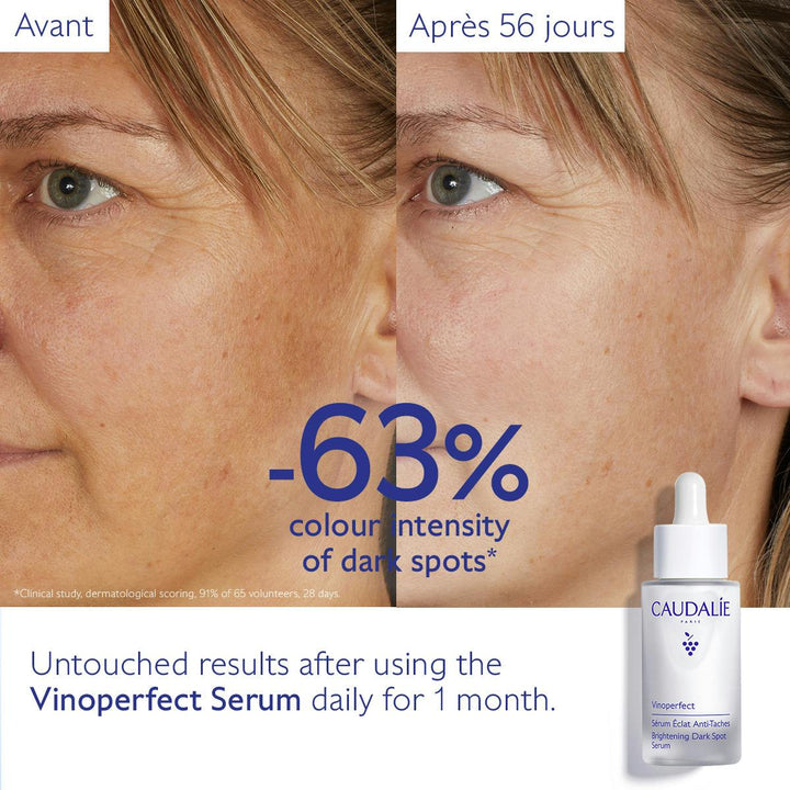 Tinh Chất Caudalie Vinoperfect Dark Spot Brightening Serum 