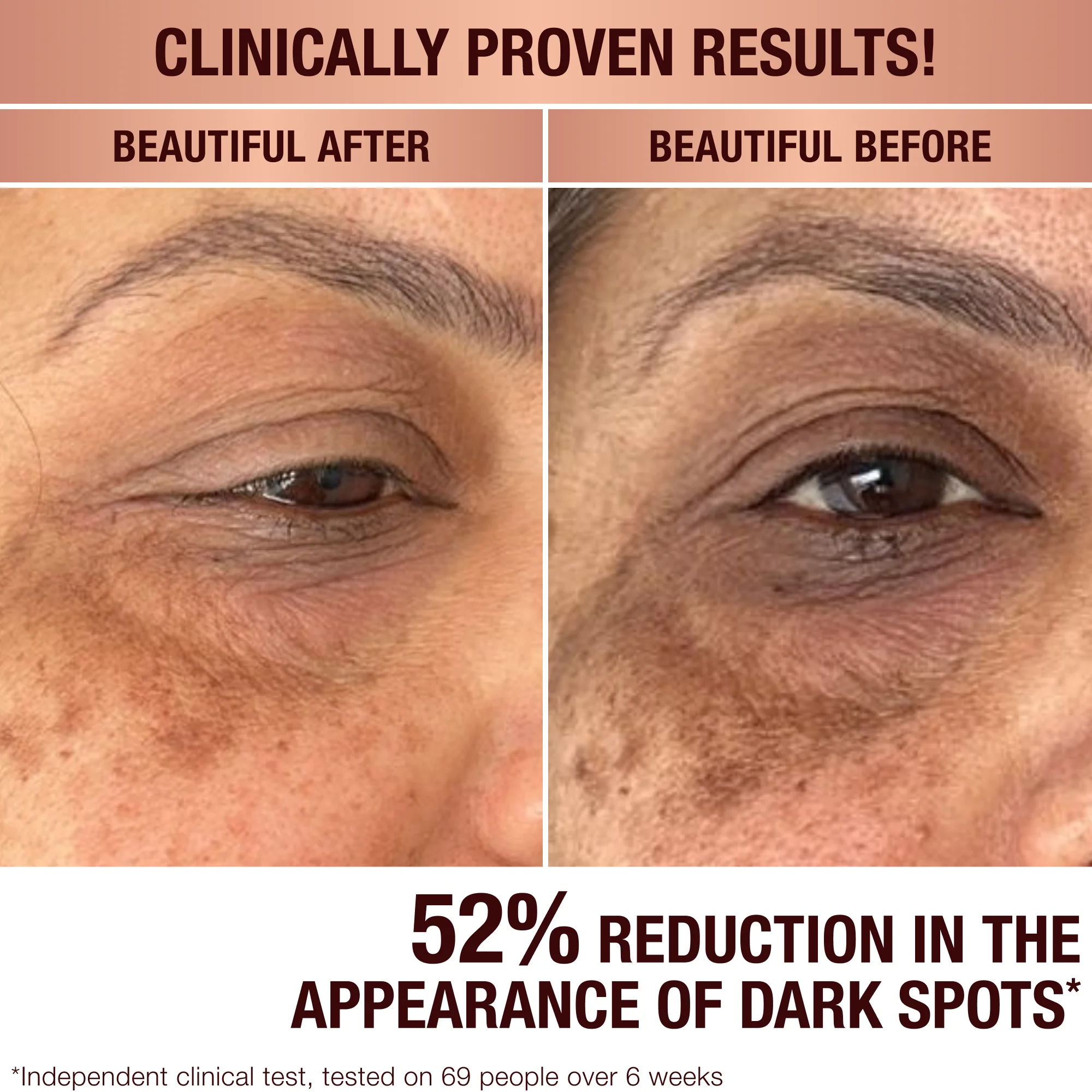 Tinh Chất Charlotte Tilbury Dark Spot Correcting Radiance Serum-Kallos